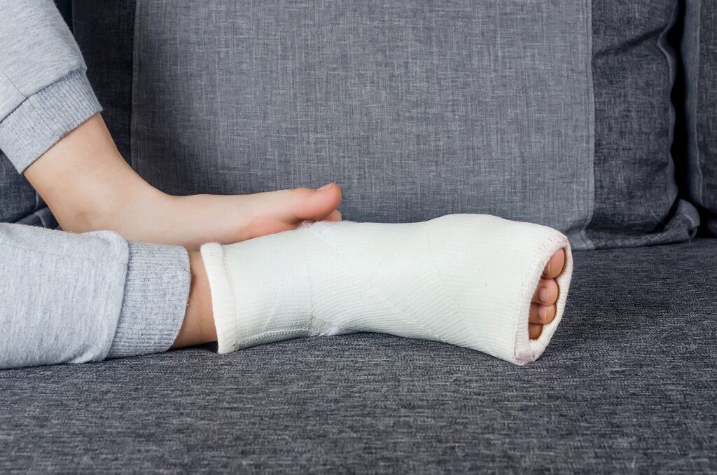 Child with Plaster bandage on leg cast and toes after injury fracture, dislocation, sprain.