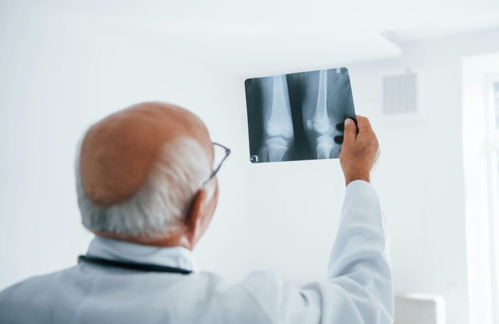 Senior man doctor in white uniform examines x-ray of human legs