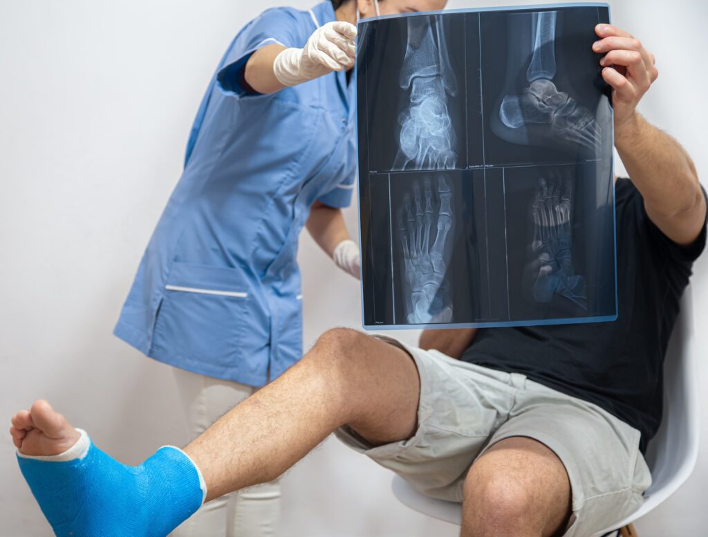 X-ray of a foot fracture close-up on a consultation with a doctor.