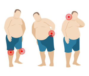 joint pain and obesity