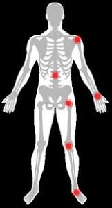 obesity and joint pain