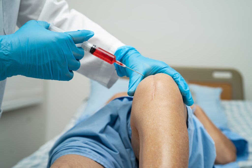 Asian doctor inject Hyaluronic acid platelet rich plasma into the knee of senior woman to walk