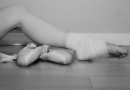 Dealing with Dance Injuries