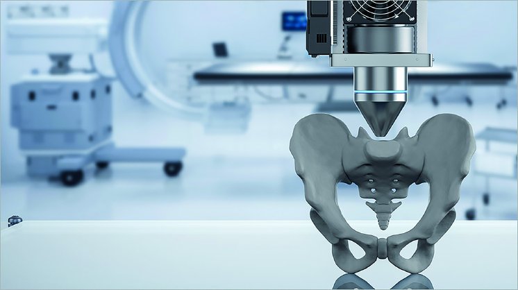  3D Printing in Orthopedics