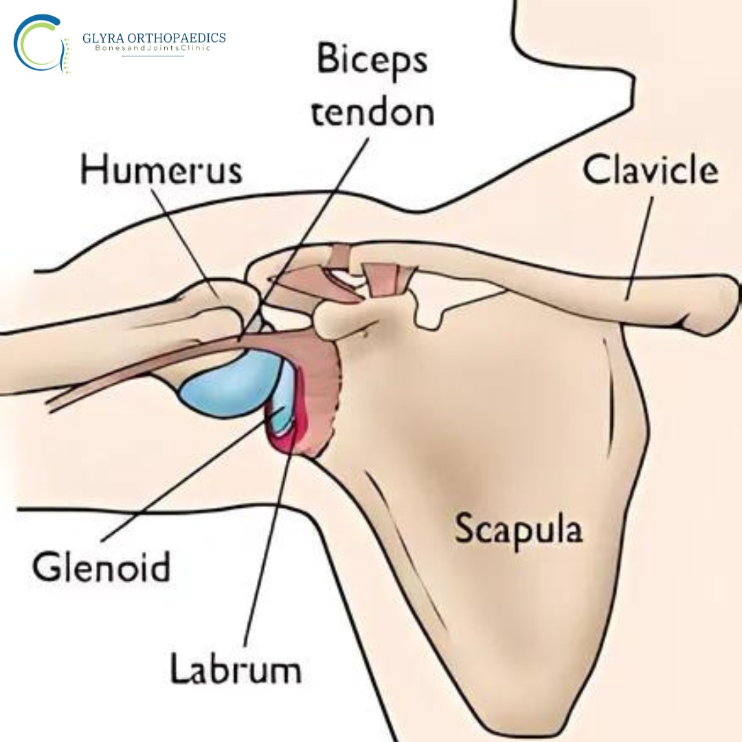 Understanding SLAP Tears: Causes, Symptoms and Treatment