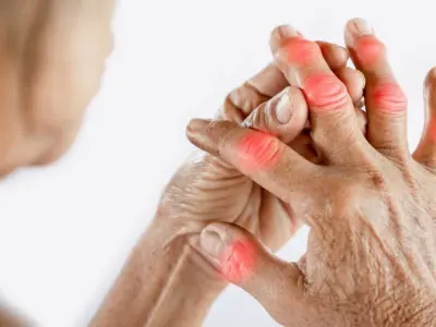 The Ultimate Guide to Rheumatoid Arthritis : Early Symptoms, Causes and Diagnosis