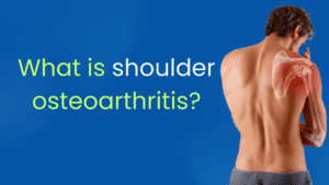 What is shoulder osteoarthritis?