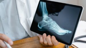 Tips to Improve Your Orthopedic Health for Life