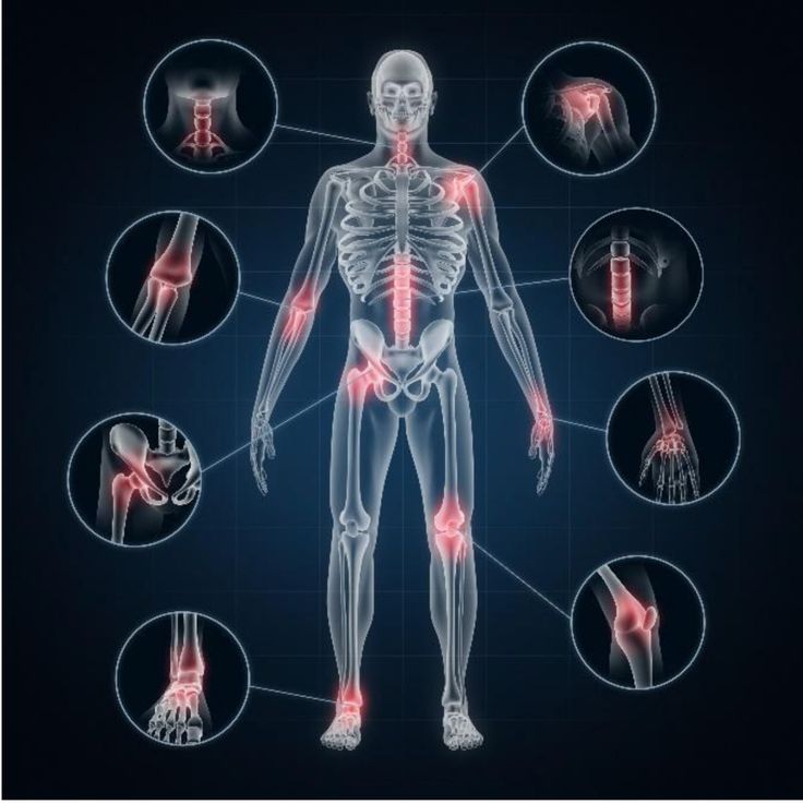 Top Foods That Strengthen Bones