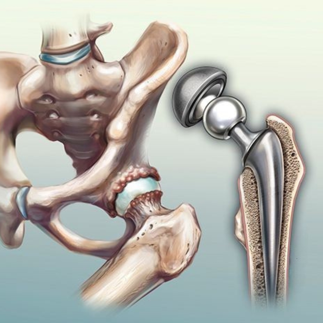 Best Hip Specialist