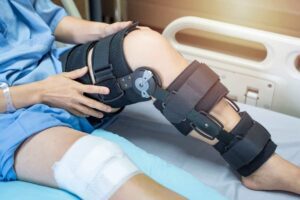ACL Injury Prevention for Athletes