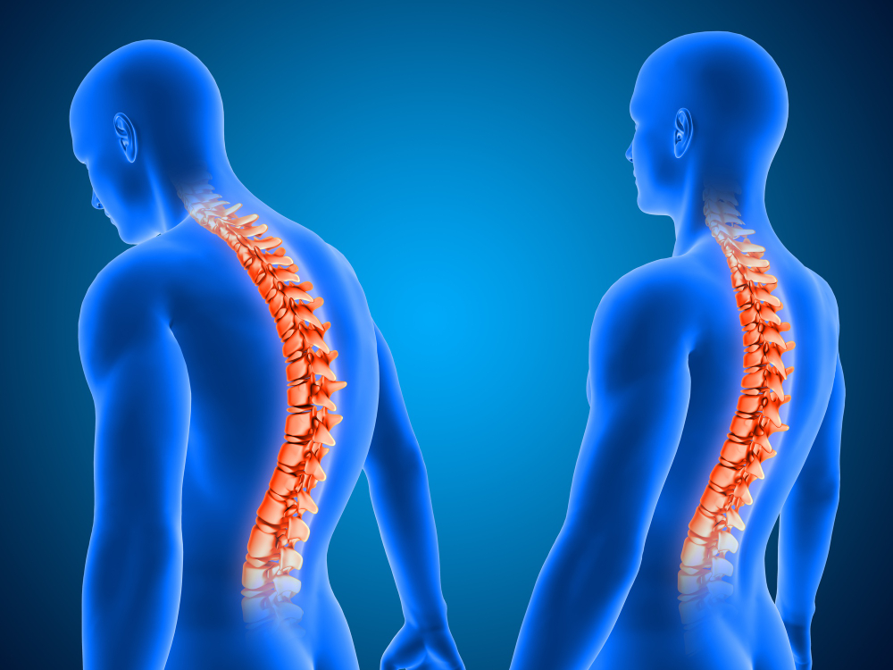 Spine Specialist for Back Pain Relief