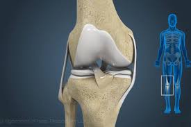 Planning ACL and PCL surgery in Delhi? Get the ultimate guide with expert tips, recovery insights, and crucial steps to ensure a successful procedure and faster healing