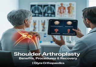 Shoulder Arthroplasty